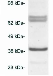 Anti-BLVRA antibody used in Western Blot (WB). GTX23466