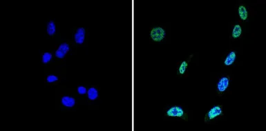 Anti-SIN3A antibody used in Immunocytochemistry/ Immunofluorescence (ICC/IF). GTX23479