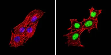 Anti-PPAR alpha (phospho Ser12) antibody used in Immunocytochemistry/ Immunofluorescence (ICC/IF). GTX23484