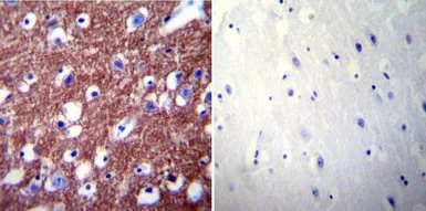 Anti-PMCA2 ATPase antibody used in IHC (Paraffin sections) (IHC-P). GTX23529