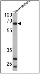 Anti-PC2 antibody used in Western Blot (WB). GTX23533