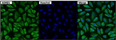 Anti-beta 1 Adrenergic Receptor antibody used in Immunocytochemistry/ Immunofluorescence (ICC/IF). GTX23546