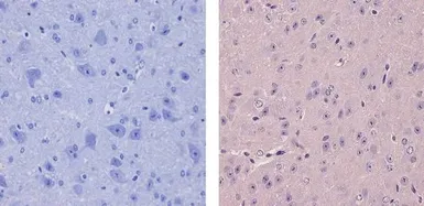 Anti-CaMK1 antibody used in IHC (Paraffin sections) (IHC-P). GTX23551