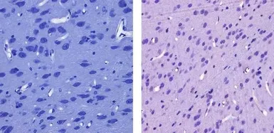 Anti-CaMK1 antibody used in IHC (Paraffin sections) (IHC-P). GTX23551