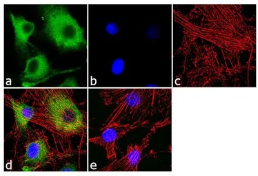 Anti-CaMK1 antibody used in Immunocytochemistry/ Immunofluorescence (ICC/IF). GTX23551