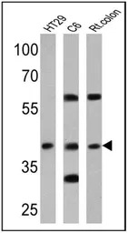 Anti-Cannabinoid receptor 2 antibody used in Western Blot (WB). GTX23561