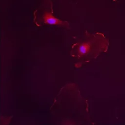 Anti-Estrogen Receptor beta antibody used in Immunocytochemistry/ Immunofluorescence (ICC/IF). GTX23577