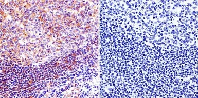 Anti-Calpain 1 antibody [9A4H8D3] used in IHC (Paraffin sections) (IHC-P). GTX23589