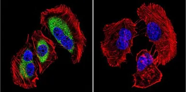 Anti-Calpain 1 antibody [9A4H8D3] used in Immunocytochemistry/ Immunofluorescence (ICC/IF). GTX23589