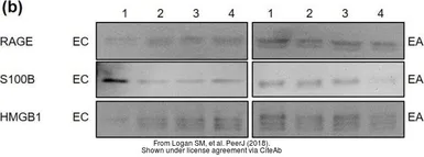 Anti-RAGE antibody used in Western Blot (WB). GTX23611