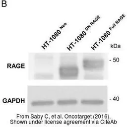 Anti-RAGE antibody used in Western Blot (WB). GTX23611