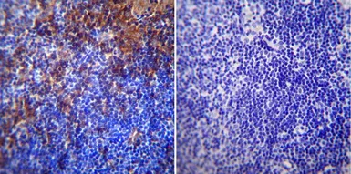 Anti-RAGE antibody used in IHC (Paraffin sections) (IHC-P). GTX23611