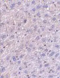 Anti-F1A alpha antibody used in IHC (Paraffin sections) (IHC-P). GTX23686