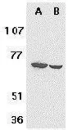 Anti-F1A alpha antibody used in Western Blot (WB). GTX23686