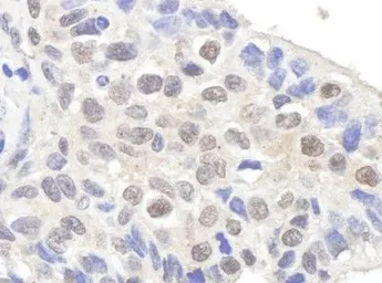 Anti-Claspin antibody used in IHC (Paraffin sections) (IHC-P). GTX23720