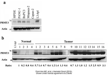 Anti-PRMT3 antibody used in Western Blot (WB). GTX23765