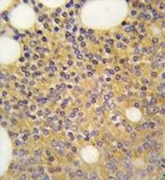 Anti-PRMT3 antibody used in IHC (Paraffin sections) (IHC-P). GTX23765