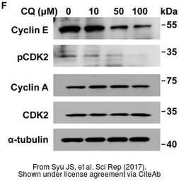 Anti-Cyclin E antibody [HE12] used in Western Blot (WB). GTX23927