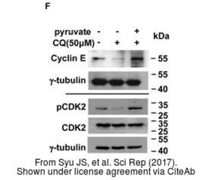 Anti-Cyclin E antibody [HE12] used in Western Blot (WB). GTX23927