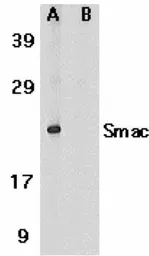 Anti-Diablo antibody used in Western Blot (WB). GTX23930