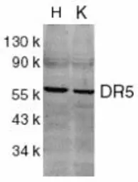 Anti-DR5 antibody used in Western Blot (WB). GTX24106