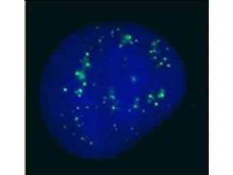 Anti-CBX4 antibody used in Immunocytochemistry/ Immunofluorescence (ICC/IF). GTX24189