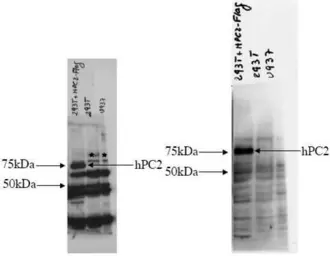 Anti-CBX4 antibody used in Western Blot (WB). GTX24189
