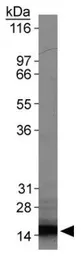 Anti-Survivin antibody [60.11] used in Western Blot (WB). GTX24470