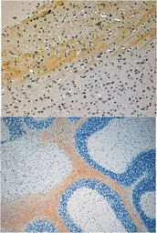 Anti-JIP3 antibody, N-term used in IHC (Paraffin sections) (IHC-P). GTX24545