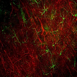 Anti-NF-L antibody [DA2] used in IHC (Free Floating) (IHC (Free Floating)). GTX24572