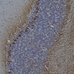 Anti-NF-L antibody [DA2] used in IHC (Paraffin sections) (IHC-P). GTX24572