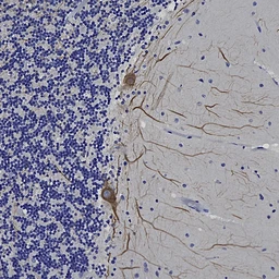 Anti-NF-L antibody [DA2] used in IHC (Paraffin sections) (IHC-P). GTX24572