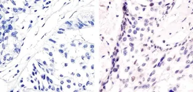 Anti-ATF2 (phospho Thr71) antibody used in IHC (Paraffin sections) (IHC-P). GTX24736