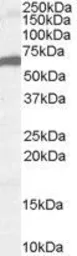 Anti-FOXA2 antibody, C-term used in Western Blot (WB). GTX25074