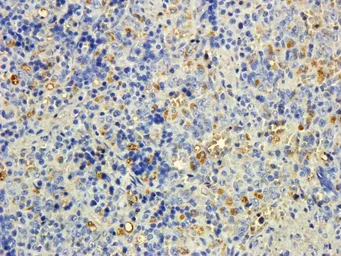 Anti-MTMR9 antibody, C-term used in IHC (Paraffin sections) (IHC-P). GTX25075