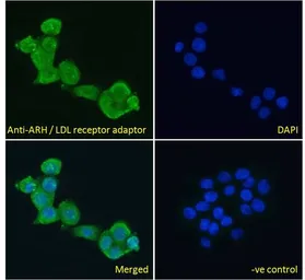 Anti-ARH antibody, N-term used in Immunocytochemistry/ Immunofluorescence (ICC/IF). GTX25082