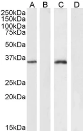 Anti-FOXL2 antibody, C-term used in Western Blot (WB). GTX25096