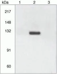 Anti-Integrin beta 3 (phospho Tyr773) antibody used in Immunoprecipitation (IP). GTX25190