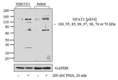 Anti-NFAT1 (phospho Ser54) antibody used in Western Blot (WB). GTX25246