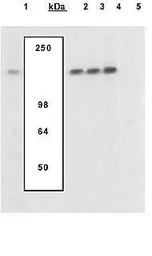 Anti-NFAT1 (phospho Ser54) antibody used in Western Blot (WB). GTX25246
