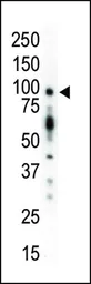 Anti-PKC mu antibody used in Western Blot (WB). GTX25283
