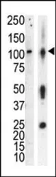 Anti-PKC nu antibody used in Western Blot (WB). GTX25285