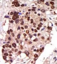 Anti-PKC nu antibody used in IHC (Paraffin sections) (IHC-P). GTX25285