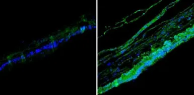 Anti-Rhodopsin antibody [1D4] used in IHC (Paraffin sections) (IHC-P). GTX25417