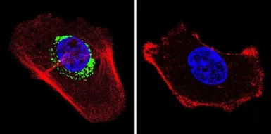 Anti-ATP5B antibody [4.3E8.D10] used in Immunocytochemistry/ Immunofluorescence (ICC/IF). GTX25432