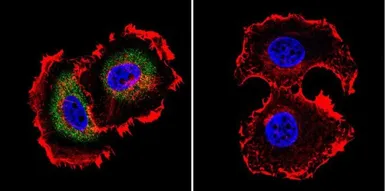 Anti-Calpain 1 antibody [2H2A7C2] used in Immunocytochemistry/ Immunofluorescence (ICC/IF). GTX25441