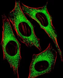 Anti-FGFR2 antibody used in Immunocytochemistry/ Immunofluorescence (ICC/IF). GTX25476