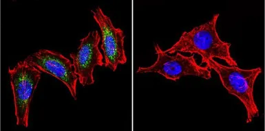 Anti-HSP60 antibody [4B9/89] used in Immunocytochemistry/ Immunofluorescence (ICC/IF). GTX25478