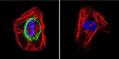Anti-TSH receptor antibody [49] used in Immunocytochemistry/ Immunofluorescence (ICC/IF). GTX25492