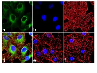 Anti-HSP27 (phospho Ser15) antibody used in Immunocytochemistry/ Immunofluorescence (ICC/IF). GTX25581